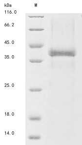 Greater than 85% as determined by SDS-PAGE.Recombinant Human Low Affinity Immunoglobulin Epsilon Fc Receptor (FCER2) Protein (His)