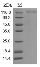 Greater than 85% as determined by SDS-PAGE.Recombinant Human Vascular Endothelial Growth Factor Receptor 1 (FLT1) Protein (His)