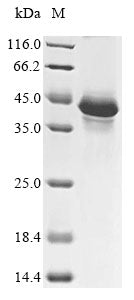 Greater than 85% as determined by SDS-PAGE.Recombinant Human Follicle-Stimulating Hormone Receptor (FSHR) Protein (His)