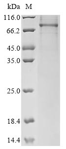 Greater than 85% as determined by SDS-PAGE.Recombinant Human Follicle-Stimulating Hormone Receptor (FSHR) Protein (hFc)