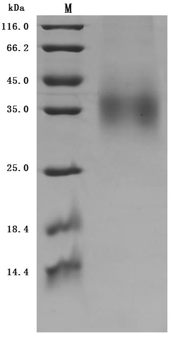 Greater than 95% as determined by SDS-PAGE.Recombinant Human Glucagon Receptor (GCGR) Protein (His&Myc), Active