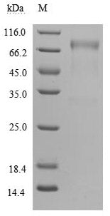 Greater than 90% as determined by SDS-PAGE.Recombinant Human Growth Hormone Receptor (GHR) Protein (hFc), Active