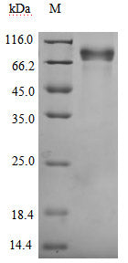 Greater than 95% as determined by SDS-PAGE.Biotinylated Recombinant Human Growth Hormone Receptor (GHR) Protein (mFc-Avi), Active