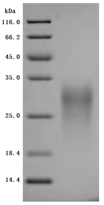 Greater than 95% as determined by SDS-PAGE.Recombinant Mouse Gastric Inhibitory Polypeptide Receptor (GIPR) Protein (His), Active