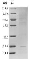 Greater than 90% as determined by SDS-PAGE.Recombinant Human Glucagon-Like Peptide 1 Receptor (GLP1R) Protein (His)