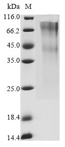 Greater than 90% as determined by SDS-PAGE.Recombinant Human Glypican-3 (GPC3) Protein (His-Myc), Active