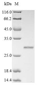 Greater than 85% as determined by SDS-PAGE.Recombinant Rat Gremlin-1 (GREM1) Protein (His&Myc)