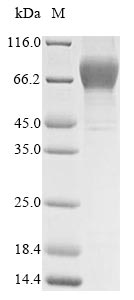 Greater than 95% as determined by SDS-PAGE.Recombinant Human Heat-Stable Enterotoxin Receptor (GUCY2C) Protein (His), Active