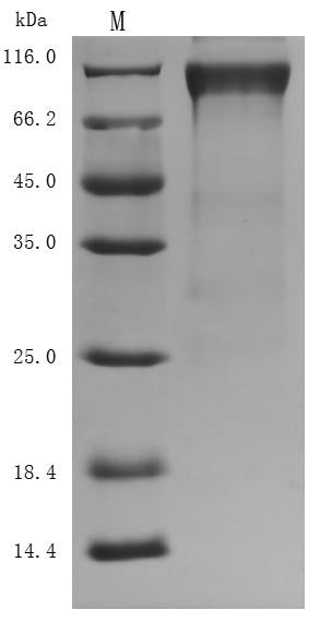 Greater than 90% as determined by SDS-PAGE.Recombinant Human Heat-Stable Enterotoxin Receptor (GUCY2C) Protein (hFc), Active