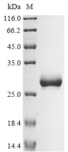 Greater than 85% as determined by SDS-PAGE.Recombinant Human Basement Membrane-Specific Heparan Sulfate Proteoglycan Core Protein (HSPG2) Protein (His&Myc)