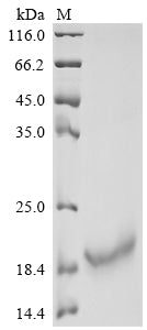 Greater than 90% as determined by SDS-PAGE.Recombinant Human Interleukin-10 (IL10) Protein (His)