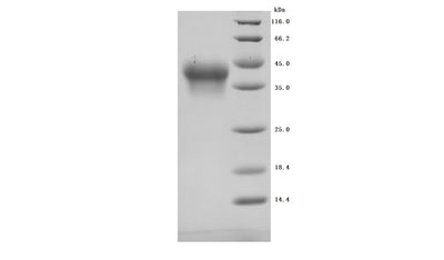 Greater than 95% as determined by SDS-PAGE.Recombinant Human Interleukin-2 Receptor Subunit Alpha (IL2RA) Protein (His), Active