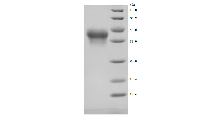 Greater than 95% as determined by SDS-PAGE.Recombinant Human Interleukin-2 Receptor Subunit Alpha (IL2RA) Protein (His), Active