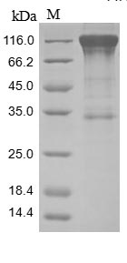 Greater than 85% as determined by SDS-PAGE.Recombinant Human Mast/Stem Cell Growth Factor Receptor Kit (KIT) Protein (hFc)