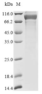 Recombinant Human Keratin, Type I Cuticular Ha4 (KRT34) Protein (hFc ...