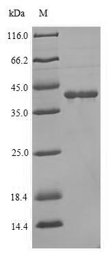 Greater than 90% as determined by SDS-PAGE.Recombinant Human Lutropin-Choriogonadotropic Hormone Receptor (LHCGR) Protein (His)