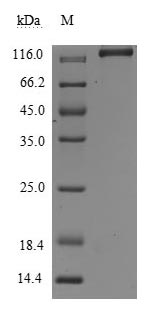 Greater than 95% as determined by SDS-PAGE.Recombinant Human Leukemia Inhibitory Factor Receptor (LIFR) Protein (hFc-Flag), Active