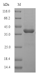 Greater than 90% as determined by SDS-PAGE.Recombinant Rat Lumican (LUM) Protein (His)