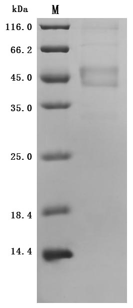 Greater than 90% as determined by SDS-PAGE.Recombinant Human Melanoma-Associated Antigen 4 (MAGEA4) Protein (His), Active