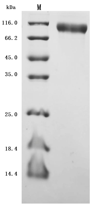 Greater than 95% as determined by SDS-PAGE.Recombinant Human Microtubule-Associated Protein Tau (MAPT) Protein (His), Active