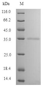 Greater than 90% as determined by SDS-PAGE.Recombinant Bovine Mannose-Binding Protein C (MBL) Protein (Flag-Myc)