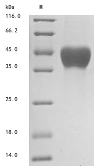 Greater than 90% as determined by SDS-PAGE.Recombinant Human Mesothelin (MSLN) Protein (His-Myc)