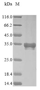 Greater than 90% as determined by SDS-PAGE.Recombinant Mouse Myocilin (MYOC) Protein (His&Myc)
