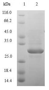 Greater than 85% as determined by SDS-PAGE.Recombinant Human Nephrin (NPHS1) Protein (His)