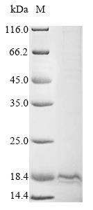 Greater than 85% as determined by SDS-PAGE.Recombinant Human Oxytocin-Neurophysin 1 (OXT) Protein (His&Myc)