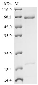 Greater than 90% as determined by SDS-PAGE.Recombinant Human Proprotein convertase subtilisin/kexin type 9 (PCSK9) Protein (His)