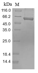 Greater than 90% as determined by SDS-PAGE.Recombinant Mouse Pyruvate Kinase Pkm (PKM) Protein (His&Myc)