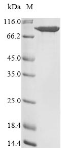 Greater than 90% as determined by SDS-PAGE.Recombinant Human Multifunctional Procollagen Lysine Hydroxylase And Glycosyltransferase Lh3 (PLOD3) Protein (His)