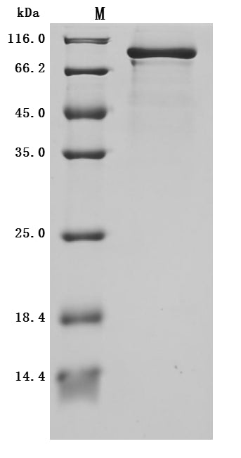 Greater than 95% as determined by SDS-PAGE.Recombinant Human Plexin-B1 (PLXNB1) Protein (mFc), Active