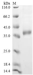 Greater than 90% as determined by SDS-PAGE.Recombinant Mouse Palmitoyl-Protein Thioesterase 1 (PPT1) Protein (His)