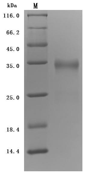 Greater than 95% as determined by SDS-PAGE.Recombinant Human Prolactin Receptor (PRLR) Protein (His), Active