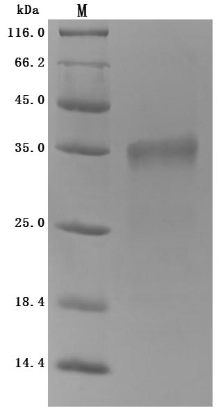Greater than 95% as determined by SDS-PAGE.Recombinant Mouse Prolactin Receptor (PRLR) Protein (His), Active