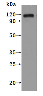 this product is detected by Mouse anti-6*His monoclonal antibody.