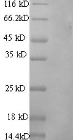 Greater than 90% as determined by SDS-PAGE.Recombinant Rat Vitamin K-Dependent Protein S (PROS1) Protein (His)