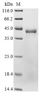 Greater than 90% as determined by SDS-PAGE.Recombinant Human Glutaminyl-Peptide Cyclotransferase (QPCT) Protein (His)