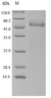 Greater than 90% as determined by SDS-PAGE.Recombinant Human Retinol-Binding Protein 4 (RBP4) Protein (hFc), Active