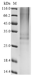 Greater than 85% as determined by SDS-PAGE.Recombinant Human Non-Secretory Ribonuclease (RNASE2) Protein (hFc)