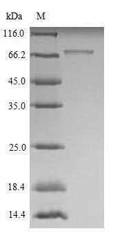 Greater than 90% as determined by SDS-PAGE.Recombinant Mouse Roundabout Homolog 1 (ROBO1) Protein (His)