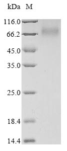 Greater than 85% as determined by SDS-PAGE.Recombinant Human Antithrombin-Iii (SERPINC1) Protein (His)