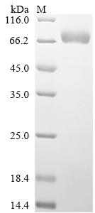 Greater than 90% as determined by SDS-PAGE.Recombinant Human Sphingomyelin Phosphodiesterase (SMPD1) Protein (His)