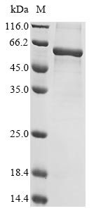 Greater than 85% as determined by SDS-PAGE.Recombinant Human Spectrin Alpha Chain, Erythrocytic 1 (SPTA1) Protein (His)