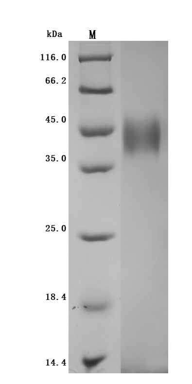 Greater than 95% as determined by SDS-PAGE.Recombinant Human Tumor-Associated Calcium Signal Transducer 2 (TACSTD2) Protein (His), Active