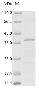 Greater than 85% as determined by SDS-PAGE.Recombinant Mouse Beta-Tectorin (TECTB) Protein (His&Myc)