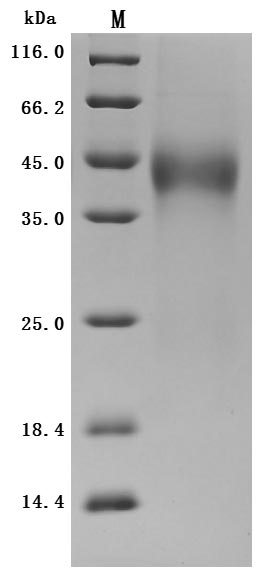 Greater than 95% as determined by SDS-PAGE.Recombinant Human Tissue Factor Pathway Inhibitor (TFPI) Protein (His), Active