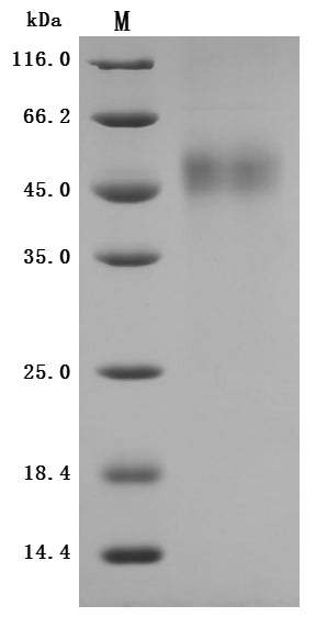 Greater than 95% as determined by SDS-PAGE.Recombinant Rabbit Tissue Factor Pathway Inhibitor (TFPI) Protein (His), Active
