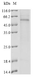 Greater than 85% as determined by SDS-PAGE.Recombinant Human Transmembrane Protease Serine 2 (TMPRSS2) Protein (His&Myc)